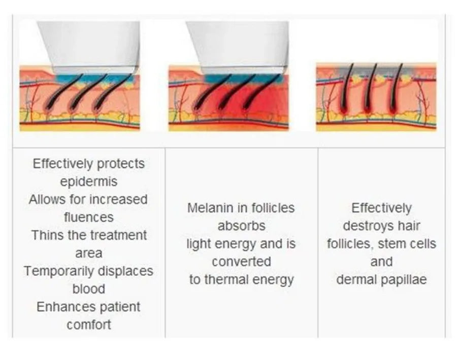 Laser Hair Removal Machine, 3 wave Ice Titanium, Painless Permanent Device for Professional Salon Depilator 808nm Diode