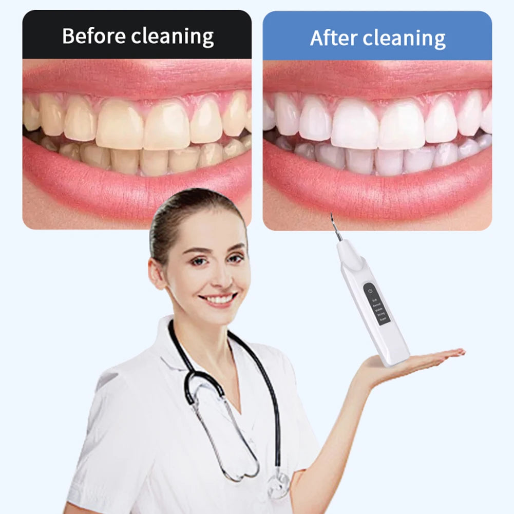Ultrasonic Dental Scaler Oral Care, Tartar Removal, Calculus Remover Tooth Stain Cleaner LED Light Tooth Whitening Tools Household