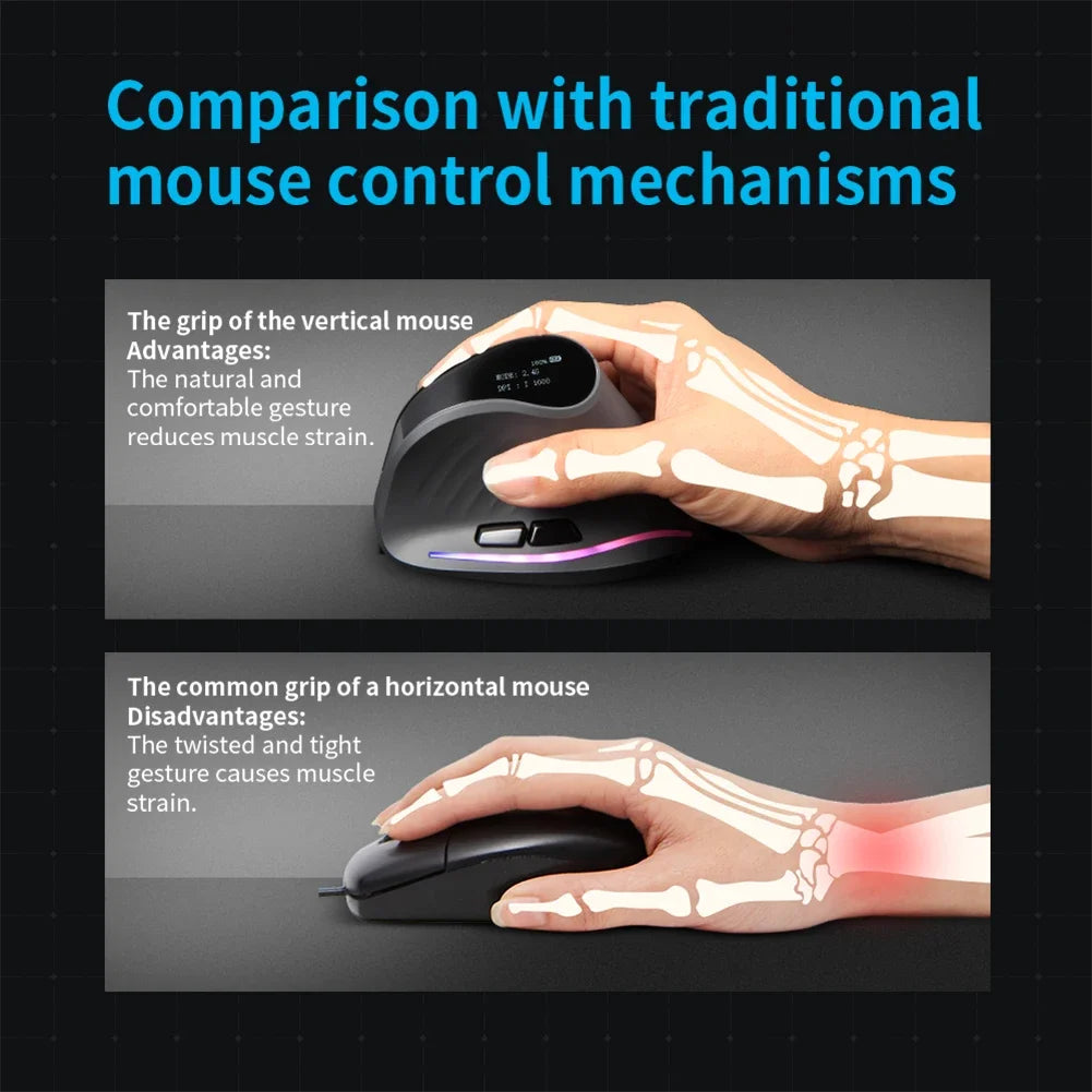 Wireless Vertical Mouse 7 Buttons Ergonomic Mouse Tri-Mode BT+2.4GHz+Wired Vertical Mouse For Laptop PC Computer Desktop