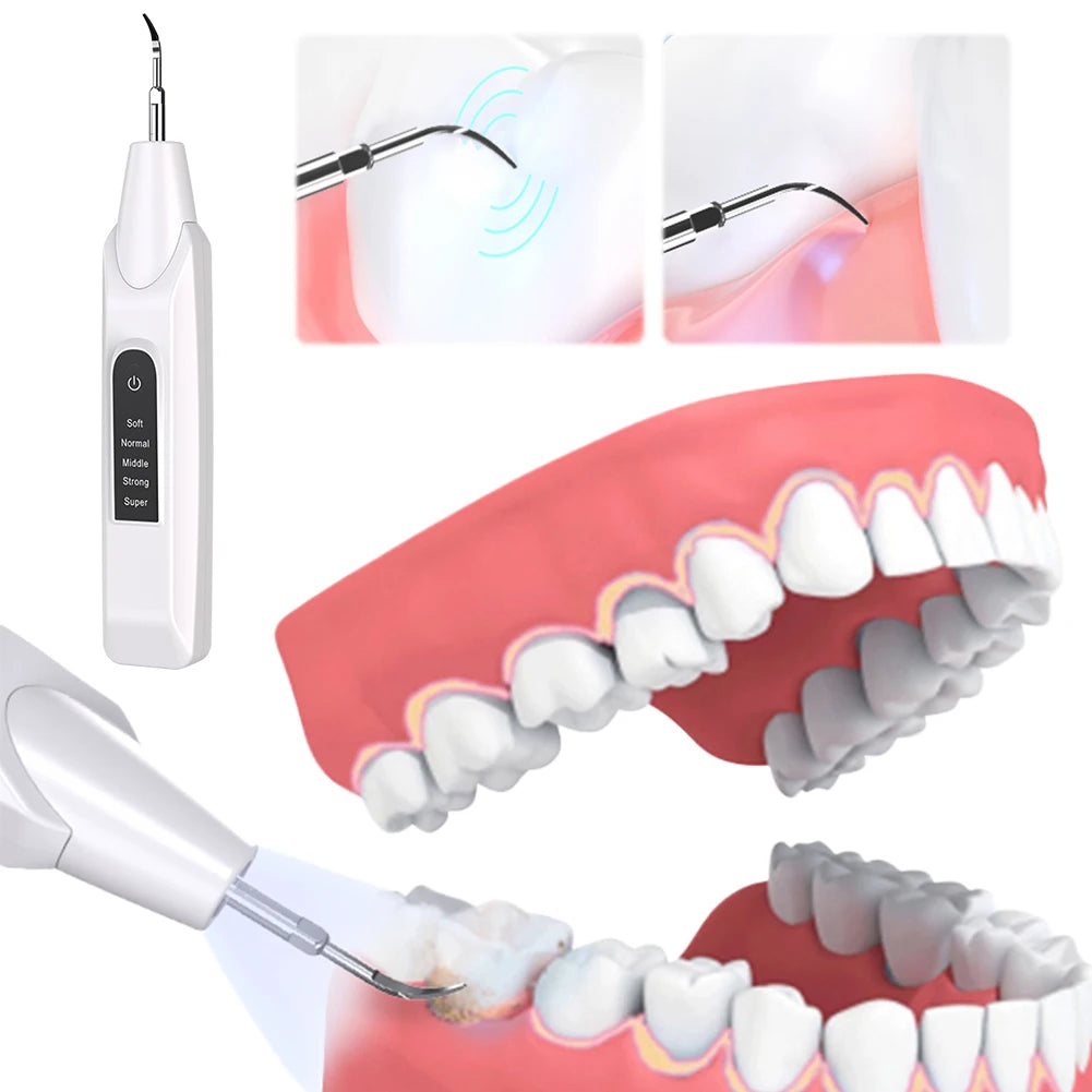 Ultrasonic Dental Scaler Oral Care, Tartar Removal, Calculus Remover Tooth Stain Cleaner LED Light Tooth Whitening Tools Household